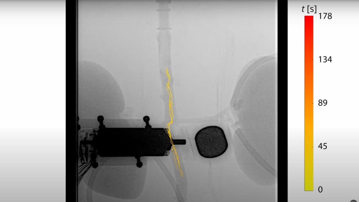 Blood clot-busting robot 4