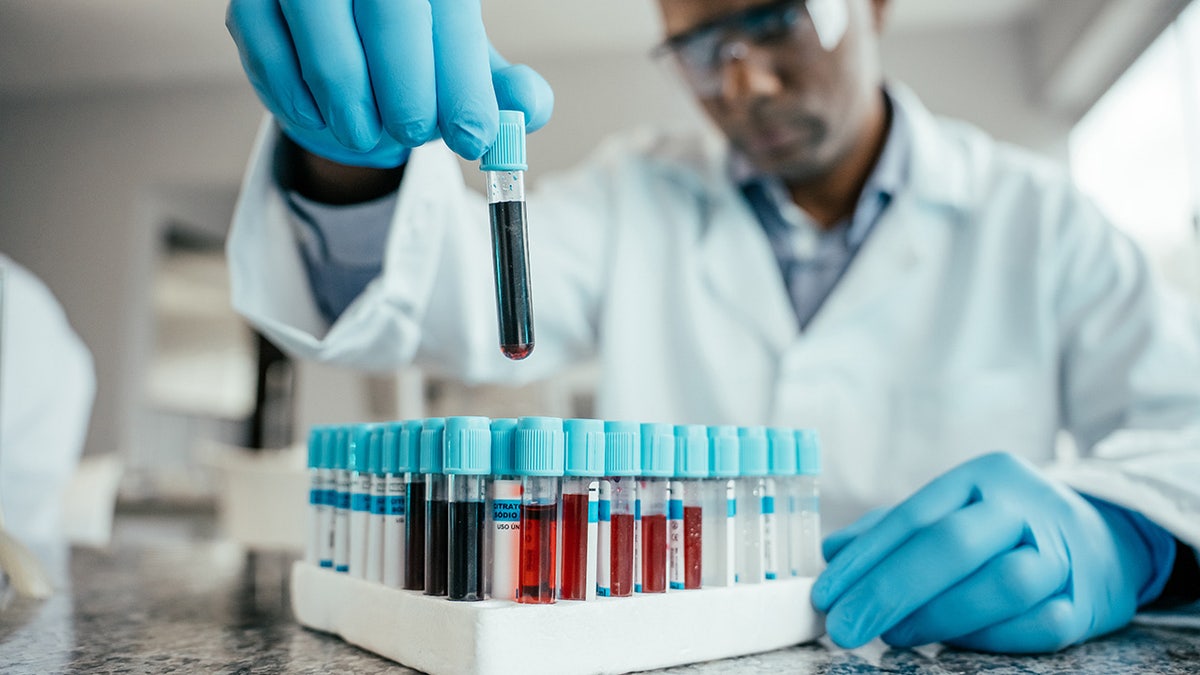Cancer could be detected three years before diagnosis with experimental blood test