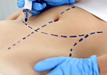Top cosmetic procedures revealed in new report: What's trending and why