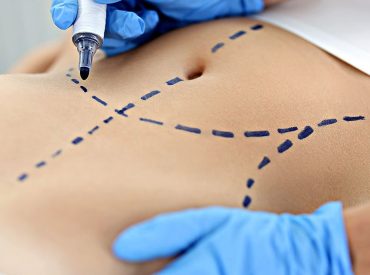 Top cosmetic procedures revealed in new report: What's trending and why