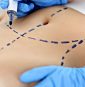 Top cosmetic procedures revealed in new report: What’s trending and why