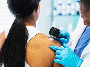 Common vitamin shown to slash skin cancer risk in some groups, study suggests