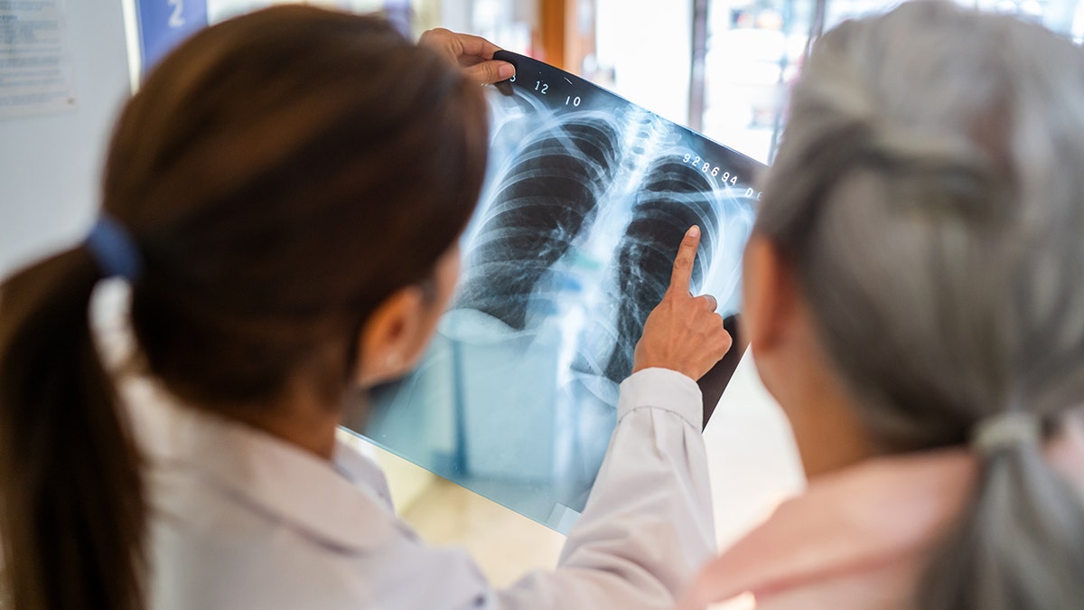 doctor and patient look at chest x-ray