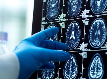 Men's brains shrink faster than women's; researchers explore Alzheimer's connection