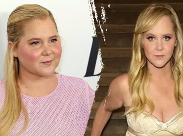 What to know about Cushing’s syndrome, which led to Amy Schumer's dramatic weight loss