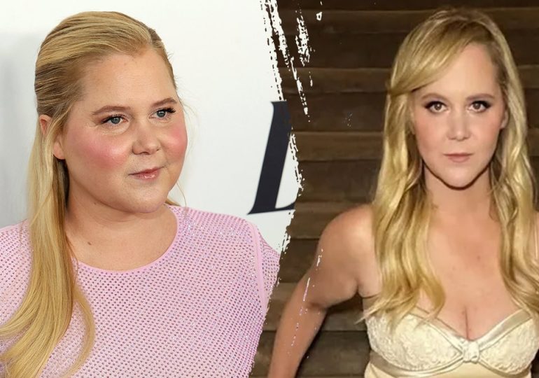 What to know about Cushing’s syndrome, which led to Amy Schumer's dramatic weight loss