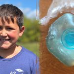 Dangerous TikTok trend leaves boy badly burned as doctors issue warning