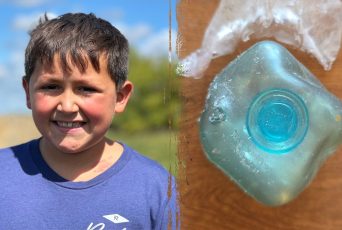 Dangerous TikTok trend leaves boy badly burned as doctors issue warning