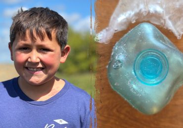 Dangerous TikTok trend leaves boy badly burned as doctors issue warning