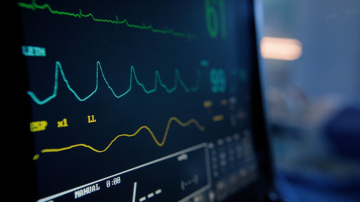 Vital signs monitor displaying heart rate and EKG readings in hospital ICU