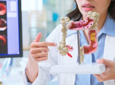 Doctors push new blood tests for colon cancer as cases surge in younger adults