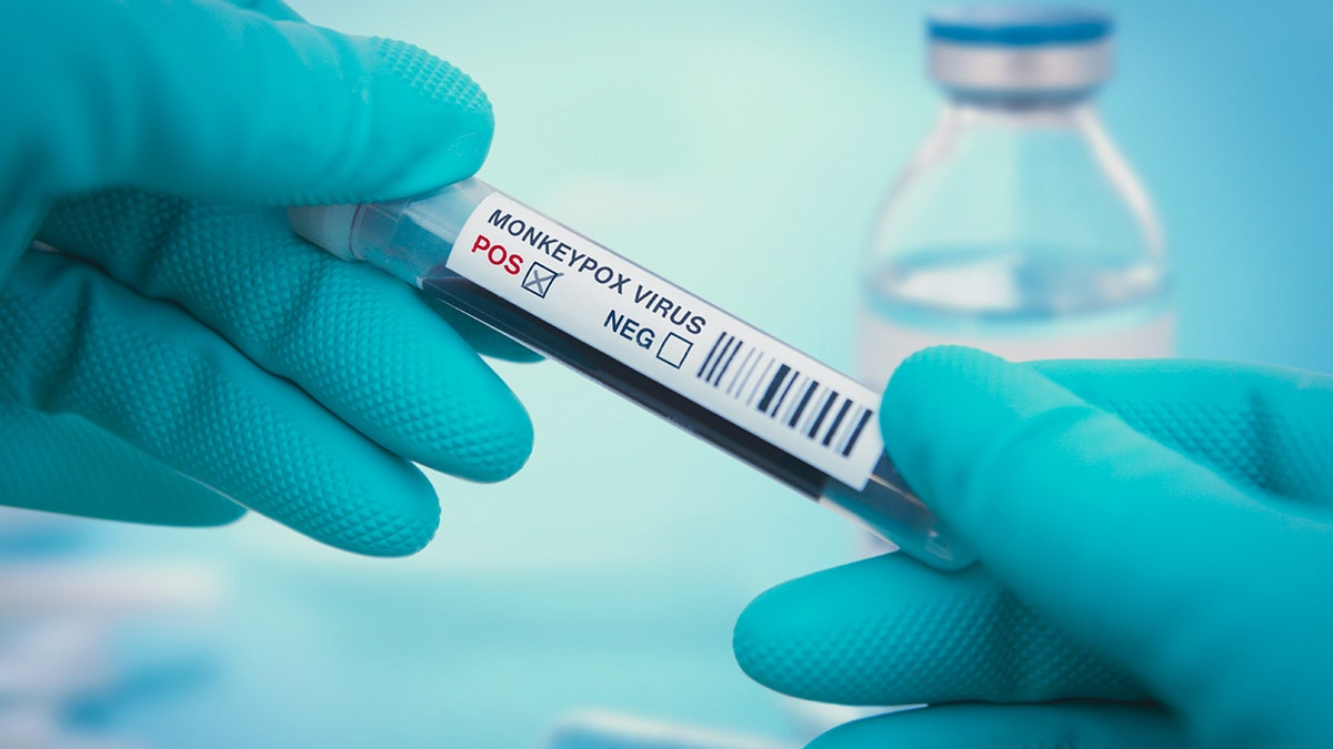 Clade I mpox virus test held in a medic's hand