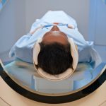 Brain tumor found during preventive scan puts full-body MRIs back in the spotlight