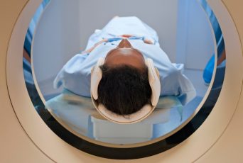 Brain tumor found during preventive scan puts full-body MRIs back in the spotlight