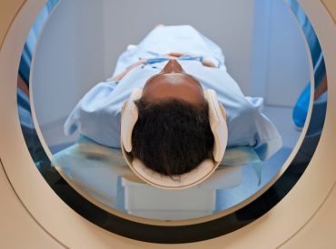 Brain tumor found during preventive scan puts full-body MRIs back in the spotlight