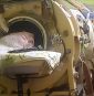 Last American to use an iron lung dies at 78 years old after childhood polio diagnosis