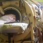 Last American to use an iron lung dies at 78 years old after childhood polio diagnosis