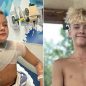 Microwaved squishy toy explodes onto boy’s face and chest amid viral trend, causing horrific burns