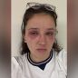 Bride cautions others before wedding day about risky beauty treatments: ‘Pain wasn’t worth it’