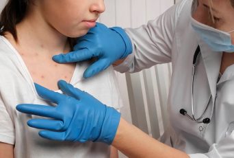 Deadly measles outbreak hits Northeast as state records first deaths in 35 years
