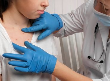 Deadly measles outbreak hits Northeast as state records first deaths in 35 years