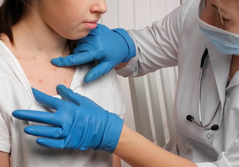 Deadly measles outbreak hits Northeast as state records first deaths in 35 years
