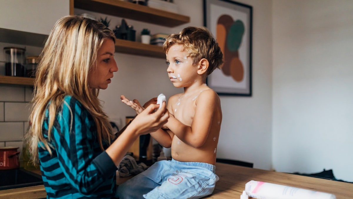 Mother with child with measles