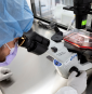 How AI could transform cancer treatment and medicine