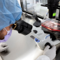 How AI could transform cancer treatment and medicine