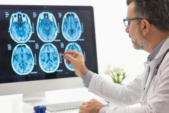 Popular foods Americans eat every day linked to silent brain damage, alarming study finds