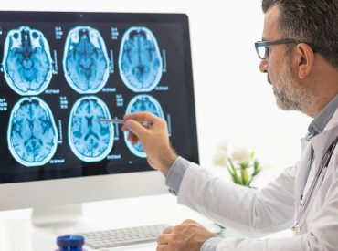 Popular foods Americans eat every day linked to silent brain damage, alarming study finds