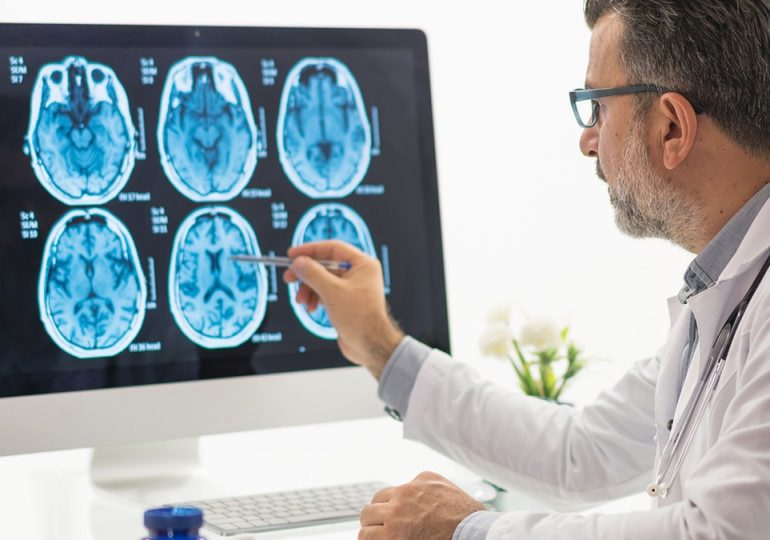 Popular foods Americans eat every day linked to silent brain damage, alarming study finds