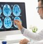 Popular foods Americans eat every day linked to silent brain damage, alarming study finds