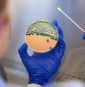 Stomach-turning sexually transmitted infection is on the rise, and standard medicines are failing
